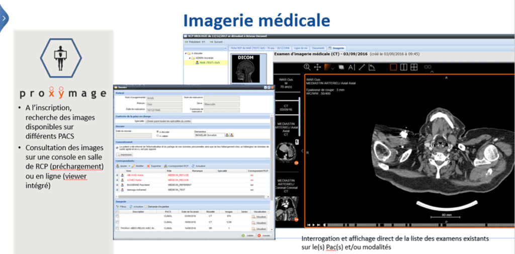 Imagerie WEBDCR